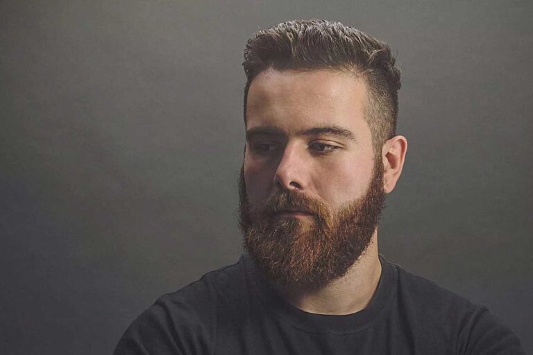 Beard Transplant In Turkey AEK Hair Clinic